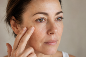 woman touching face with textured skin