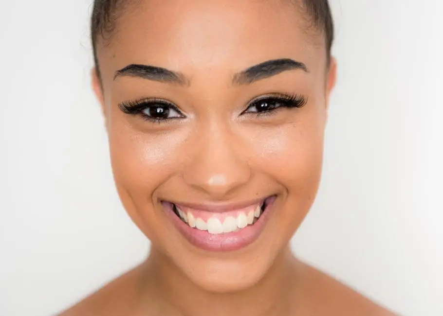 Gummy Smile Treatment Surrey