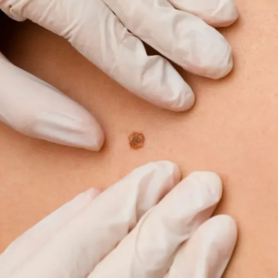 Minor Surgery Surrey