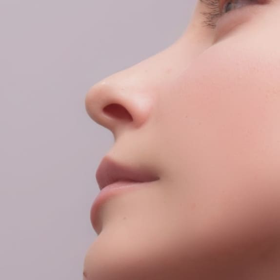 Non-Surgical Rhinoplasty Surrey
