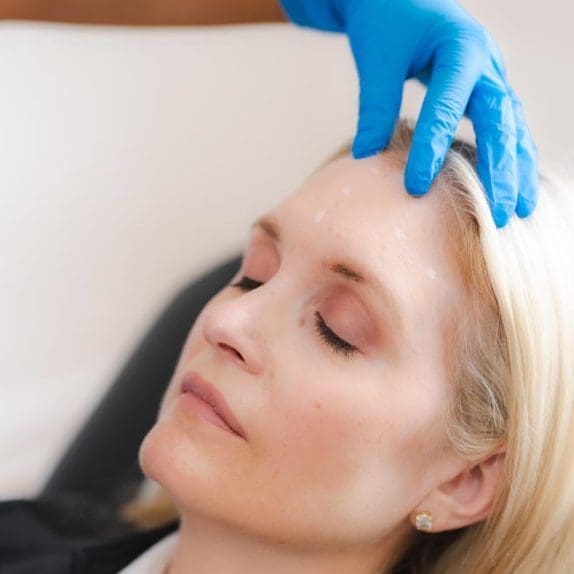 Forehead Lines Treatment