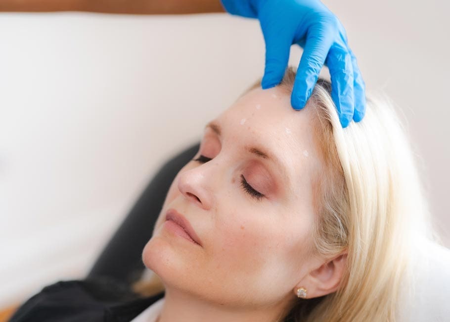 Forehead Lines Treatment