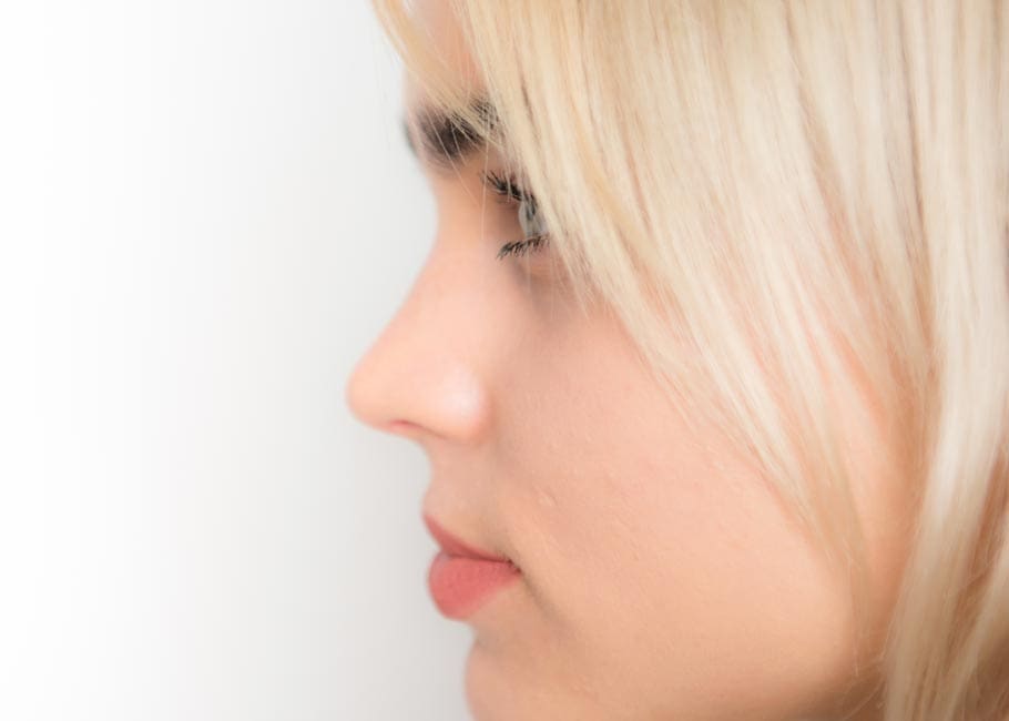 Non-Surgical Rhinoplasty