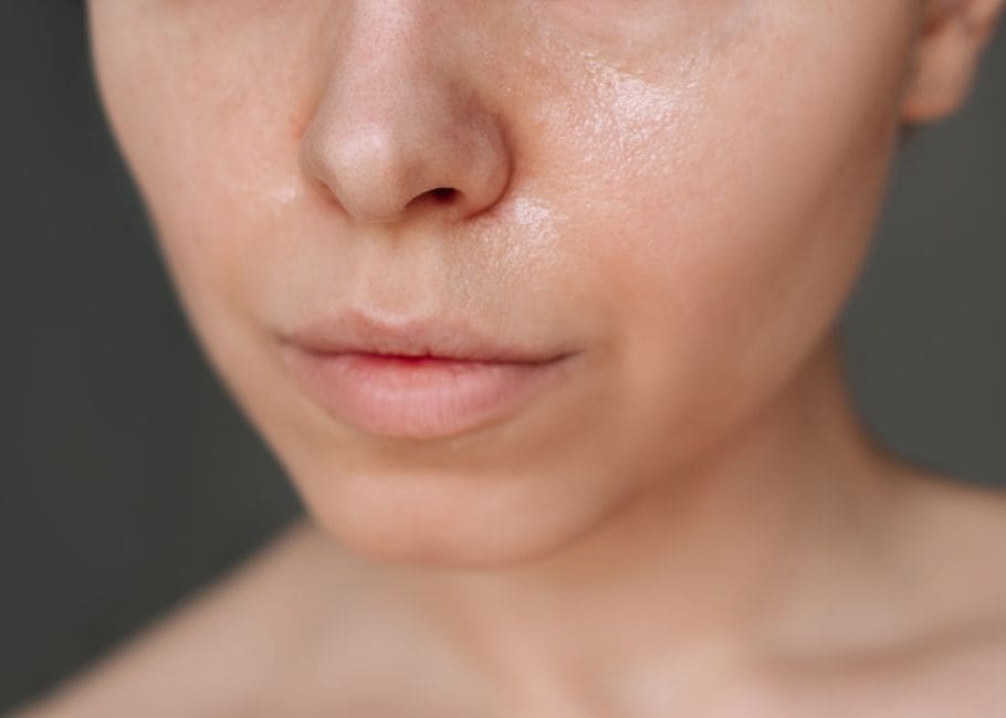 close up of dull skin face