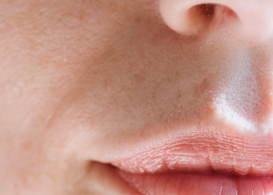 close up of minimal folds around mouth