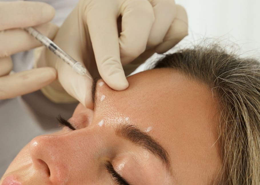close up of non surgical brow lift treatment