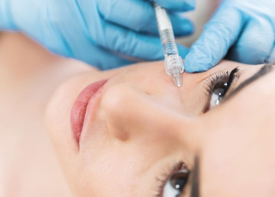 close up of tear trough filler treatment