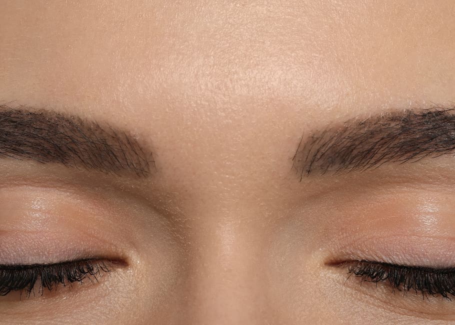 Reduced muscle activity from botox on frown lines image