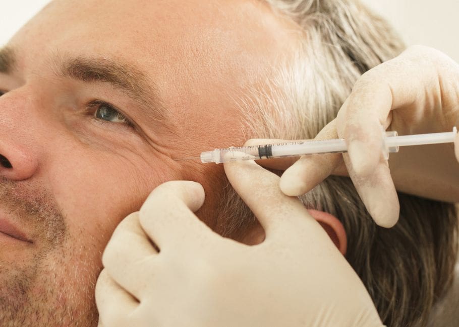 man getting temple filler near eyes