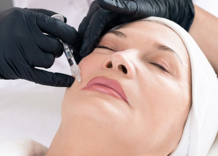 marionette line treatment