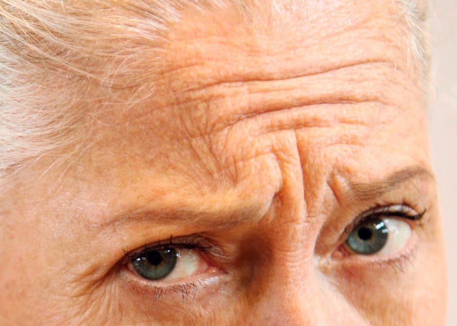older woman with deep frown lines