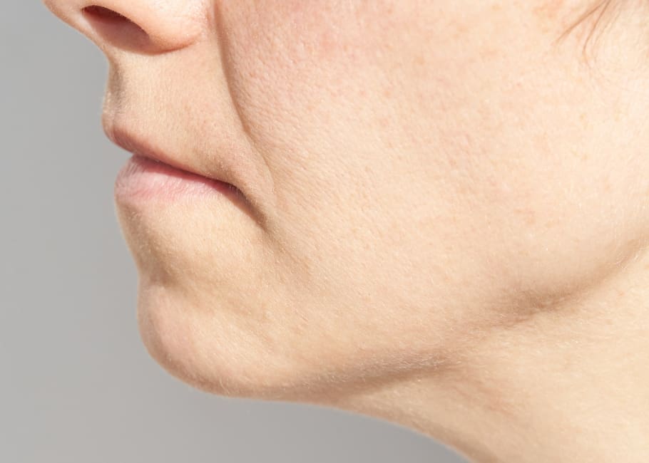 older woman with sagging jawline