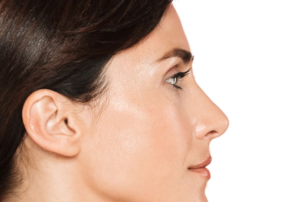 side profile of woman with perfect rhinoplasty treatment