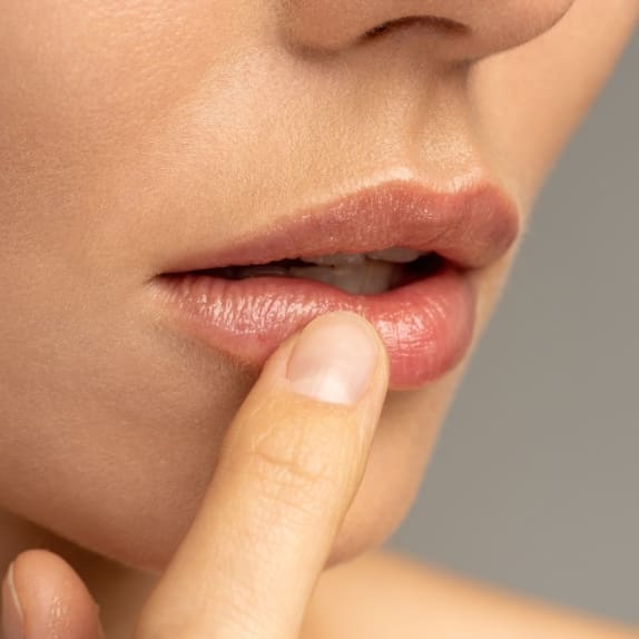 Lip Fillers Surrey