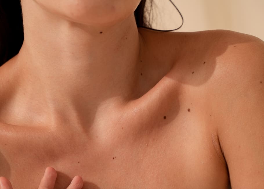woman with healthy skin