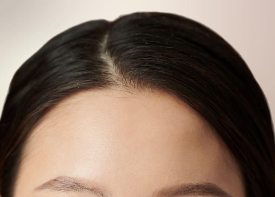 woman with smooth forehead