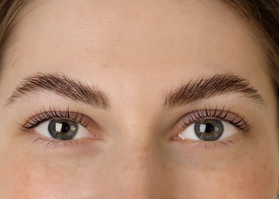 woman with symmetrical eye brows after treatment