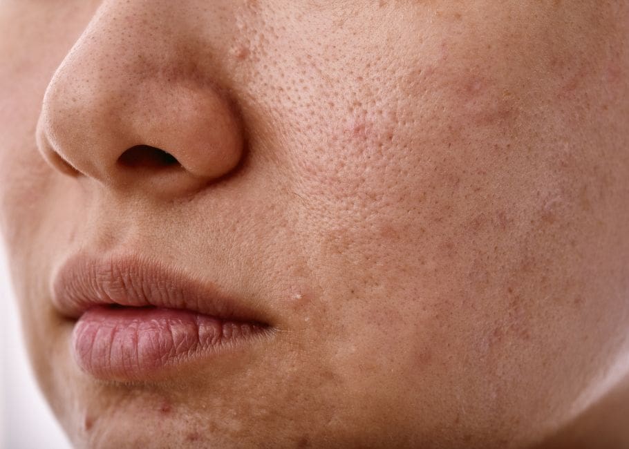 close up of dull skin before polynucleotides