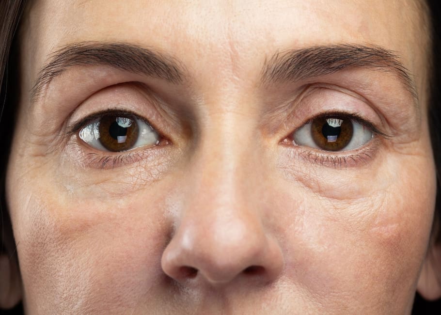 older woman with dull skin and volume loss