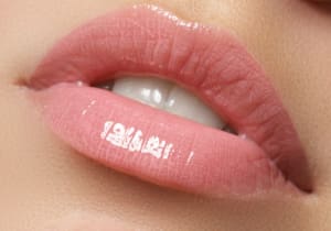 How Long Do Lip Fillers Last?