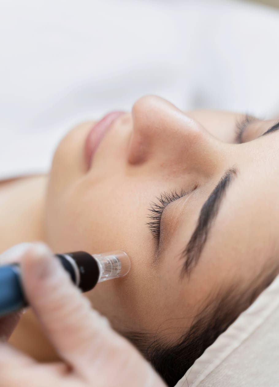 woman getting skinpen treatment
