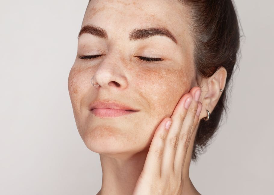 Skin Lesion Removal Surrey